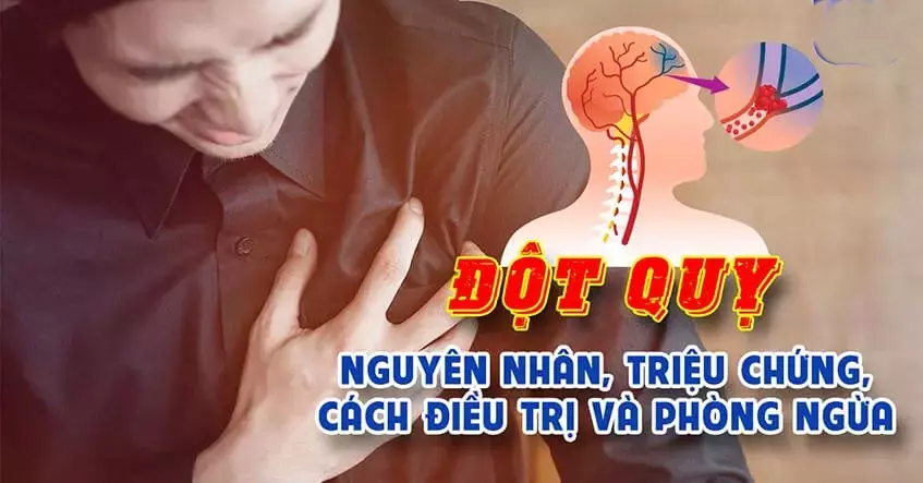 ĐỘT QUỴ LÀ GÌ? NGUYÊN NHÂN VÀ CÁCH CHẨN ĐOÁN BỆNH